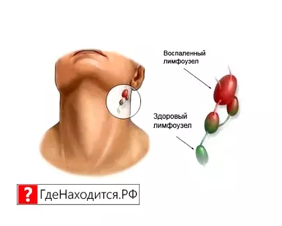 Где Находятся Лимфоузлы У Человека Фото